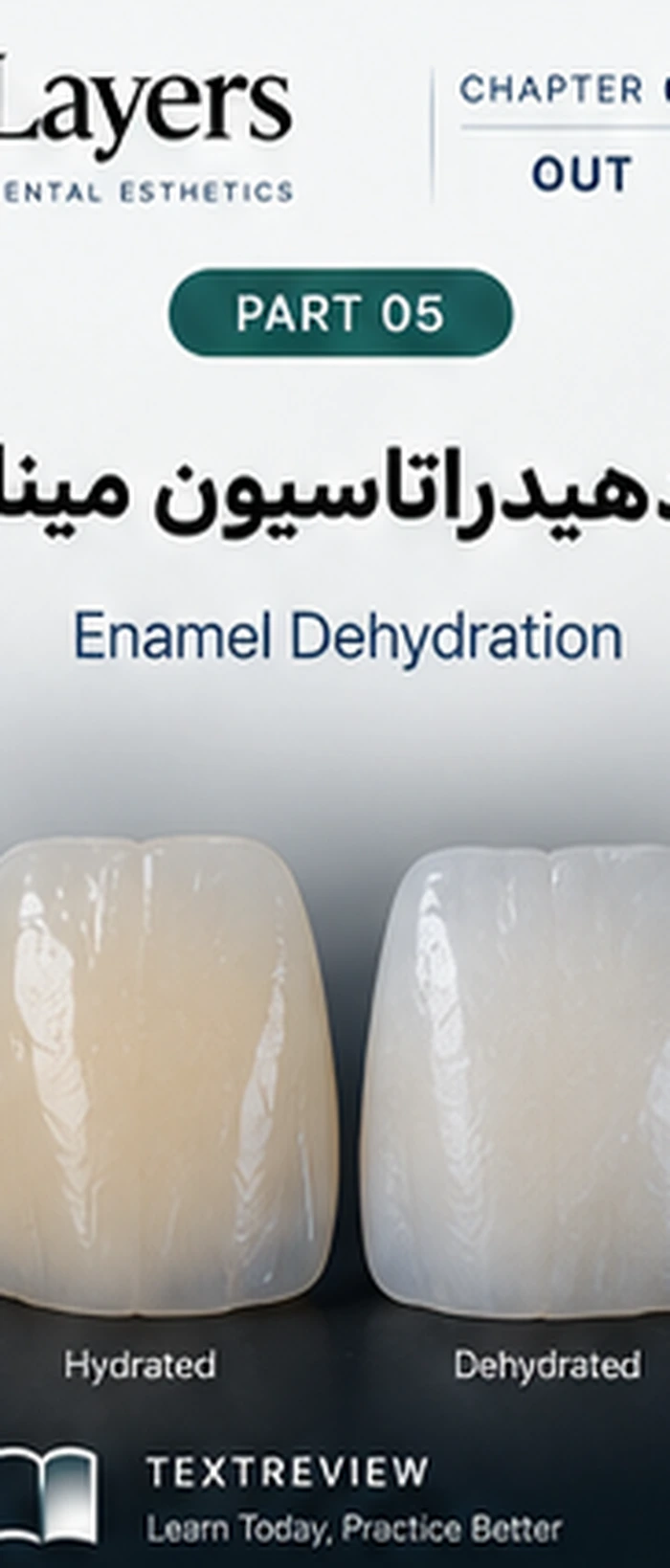 دهیدراتاسیون مینا و انتخاب رنگ