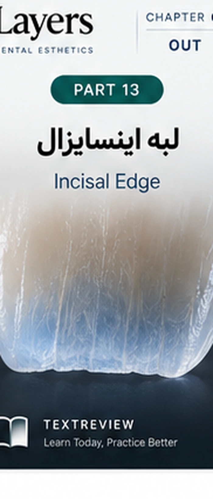 بازسازی لبه اینسایزال با مینا و عاج