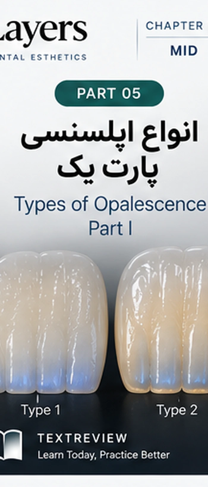 انواع اپلسنسی؛ ماملون تایپ یک و دو