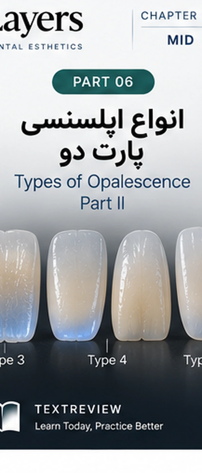 انواع اپلسنسی؛ تایپ سه، چهار و پنج