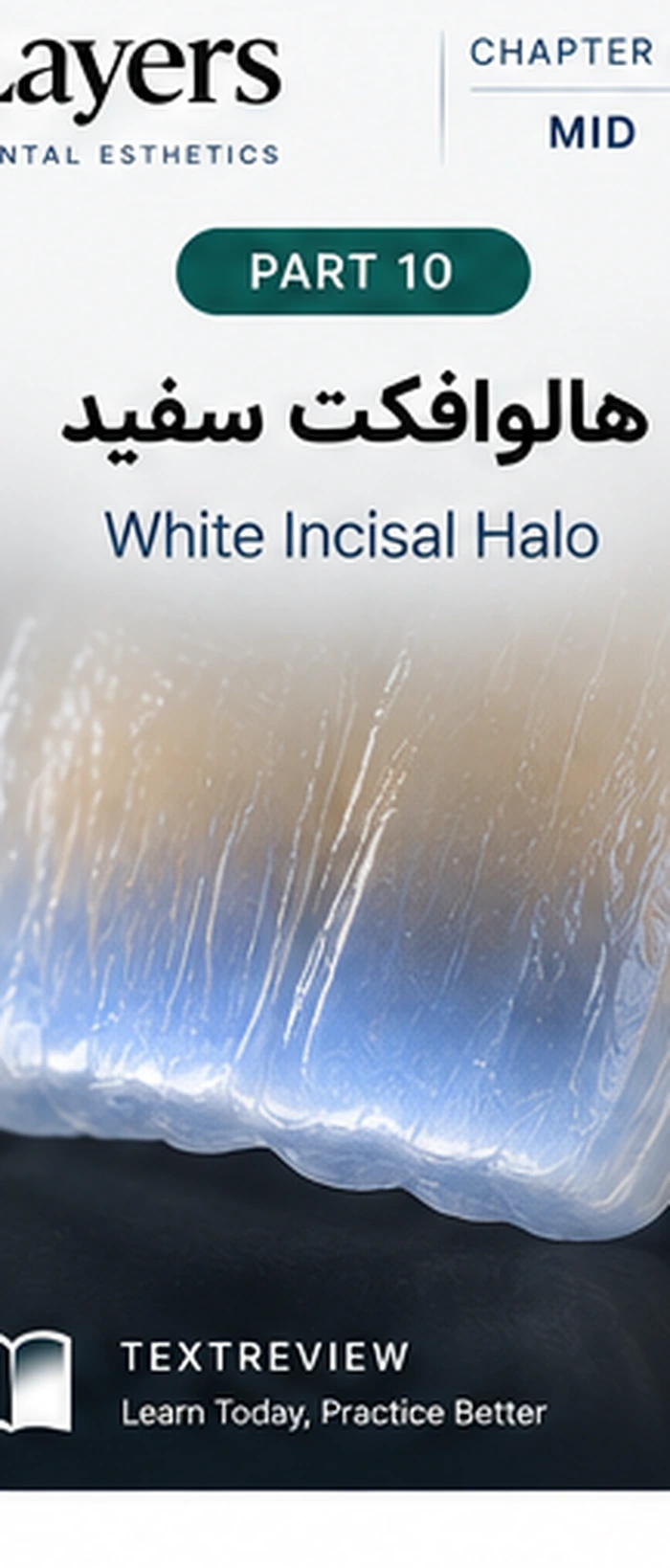 هالوافکت سفید؛ بازسازی Incisal Halo